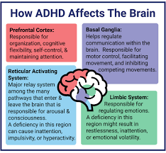 ADHD in Females: Identifying Underdiagnosis and Difficulties