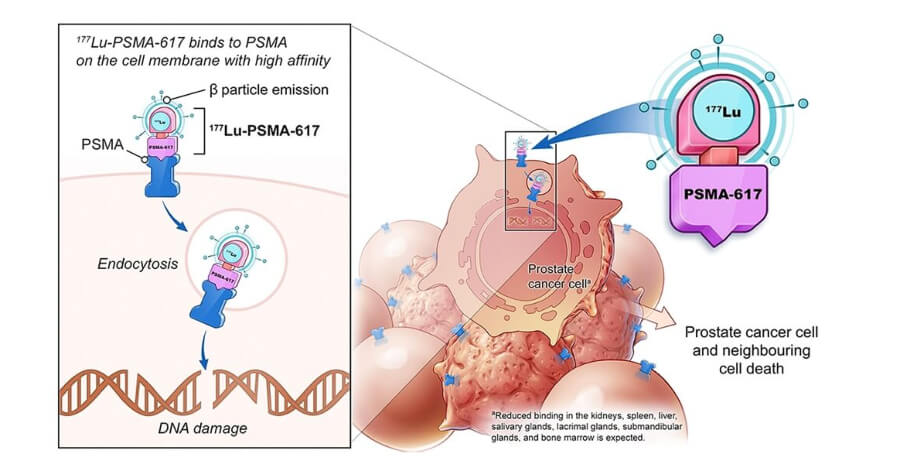 What cancer does lutetium-177 treat?