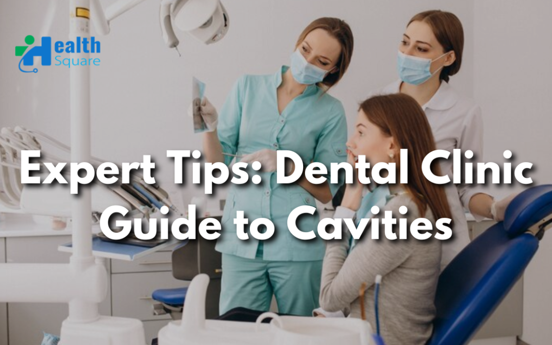 Expert Tips: Dental Clinic Guide to Cavities