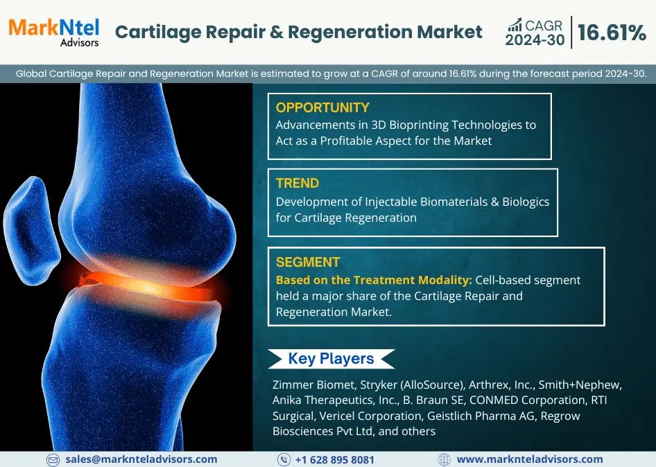 Tamaño del mercado de reparación y regeneración de cartílago, participación y pronóstico de crecimiento | Se espera un crecimiento CAGR del 16,61%