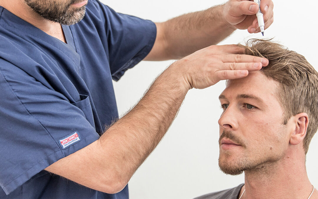 The Importance of Research in Understanding Hair Transplant Cost