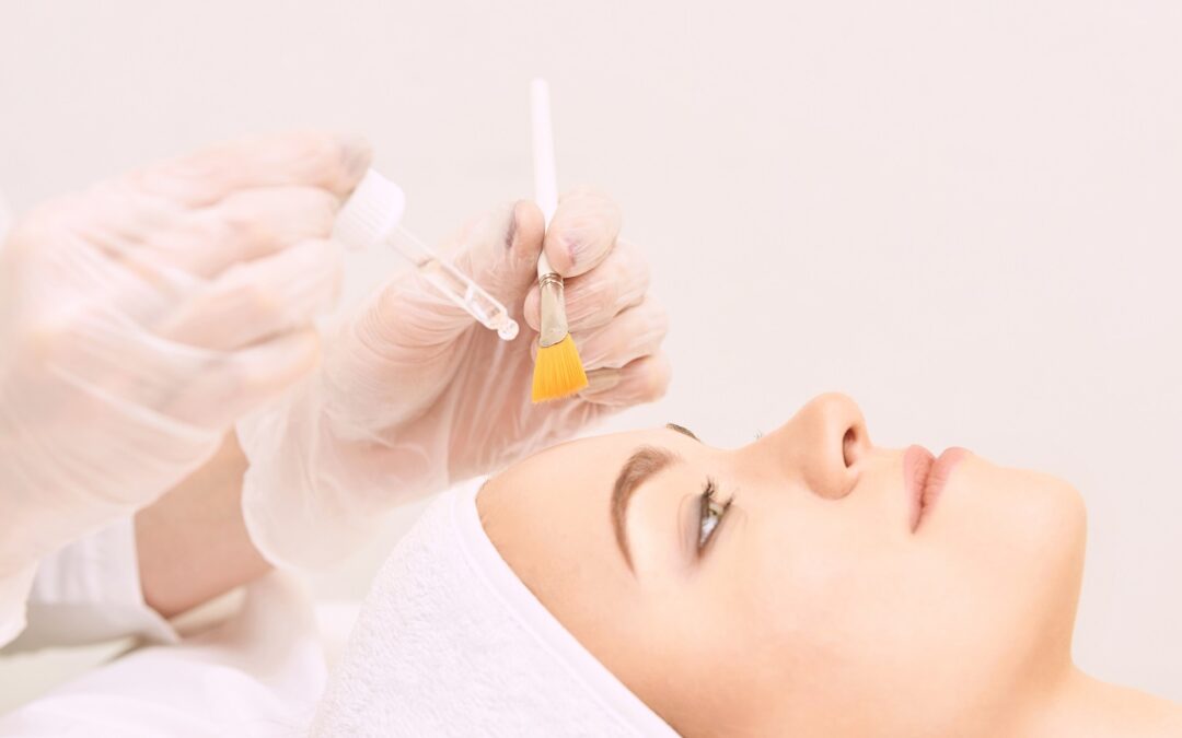 Exploring Chemical Peels for Aging Skin: Dubai’s Anti-Aging Solutions