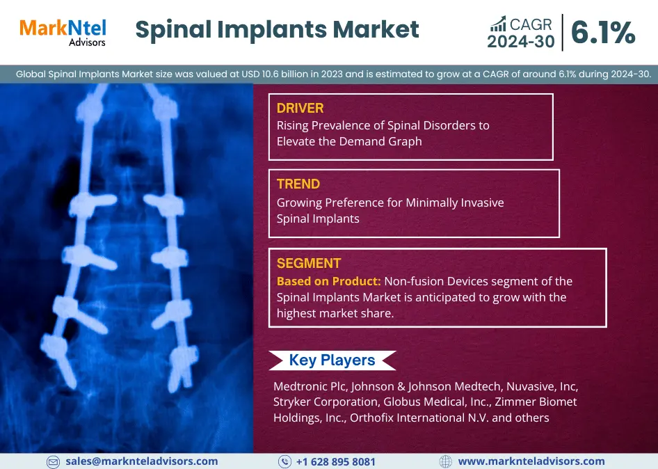 Spinal Implants Market Size, Share, News, Demand, Opportunity and Forecast: -2030