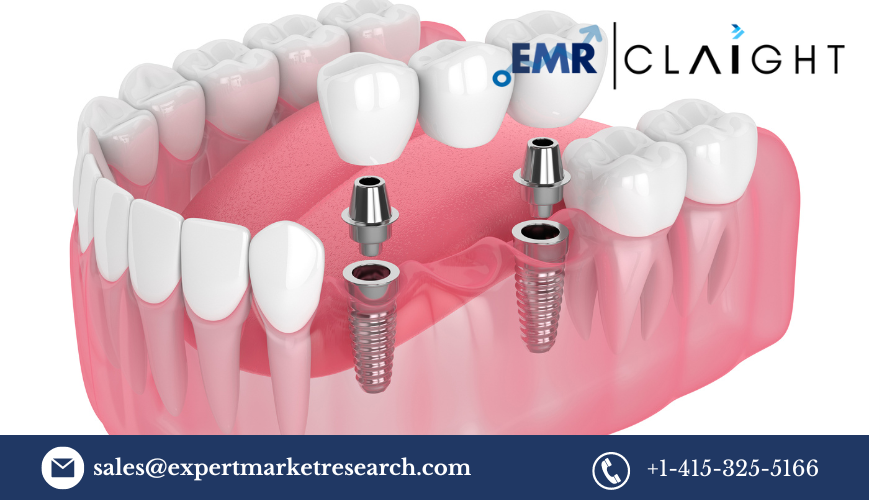 Dental 3D Printing Market