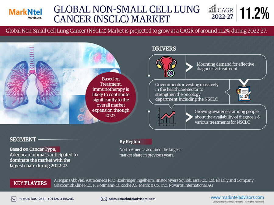 Non-Small Cell Lung Cancer Market Key Finding, Latest Trends Analysis, Progression Status, Revenue and Forecast – 2027