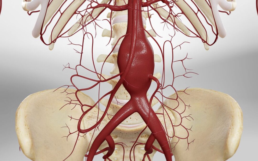 North America Aortic Stent Graft Market