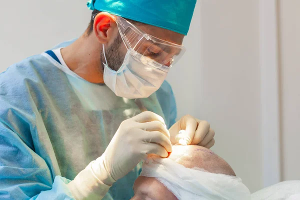 Take these precautions before undergoing hair transplant surgery