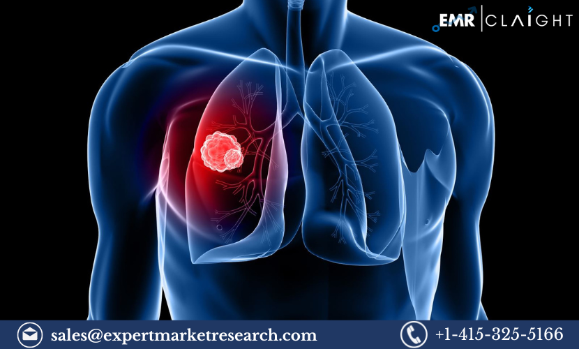 Lung Cancer Screening Market: In-Depth Analysis of Trends, Growth, and Competitive Landscape