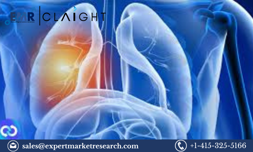 Non-Small Cell Lung Cancer (NSCLC) Treatment Market Report 2024-2032