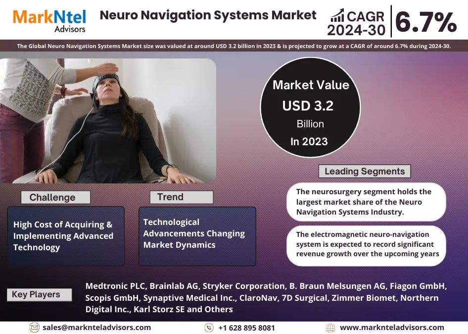 Key Manufacturers Operating in Neuro Navigation Systems Market to Hit Lucrative Growth CAGR of 6.7% by 2030