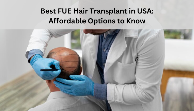 Best FUE Hair Transplant in USA: Affordable Options to Know